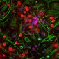 Anti-Ubiquitin C-terminal Hydrolase 1 (UCHL1) Antibody
